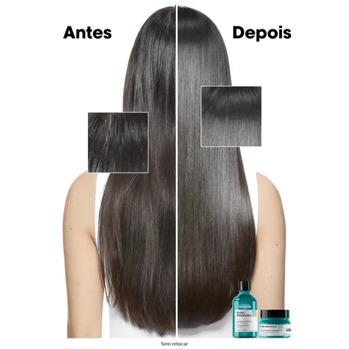 L’Oréal Pro Serie Expert Scalp Advanced Argila 2 Em 1 Para Cabelo Oleoso